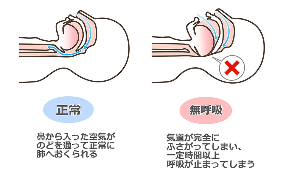 気道のイラスト